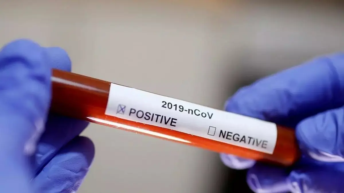 وفاة السياسي التونسي كمال السعيدي بفيروس كورونا المستجد