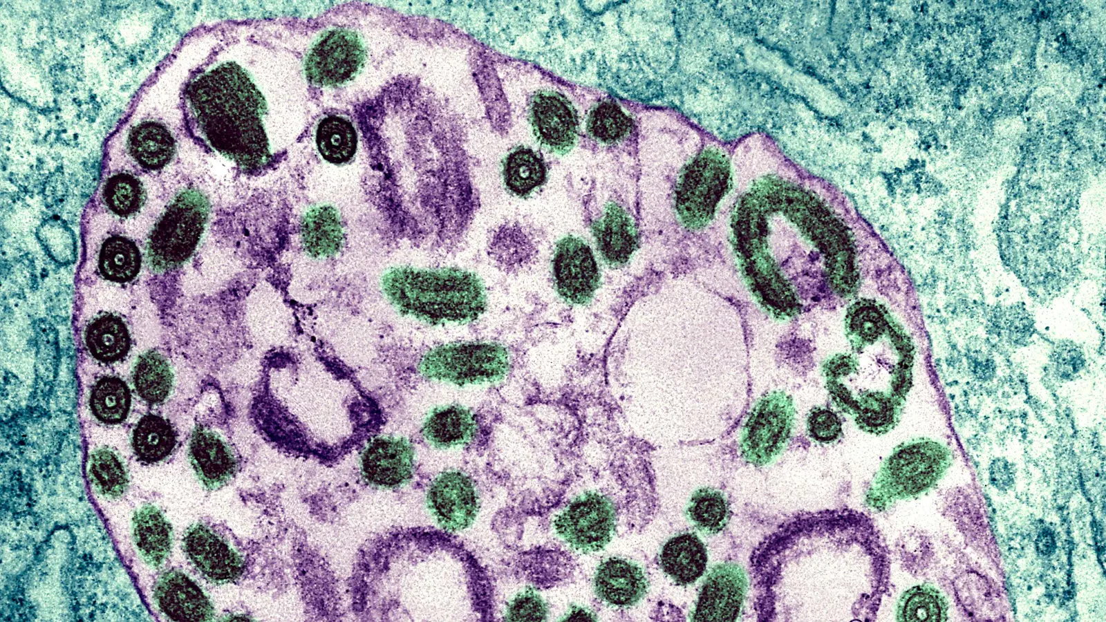 وفاة 6 أشخاص بسبب "فيروس ماربورغ" في رواندا