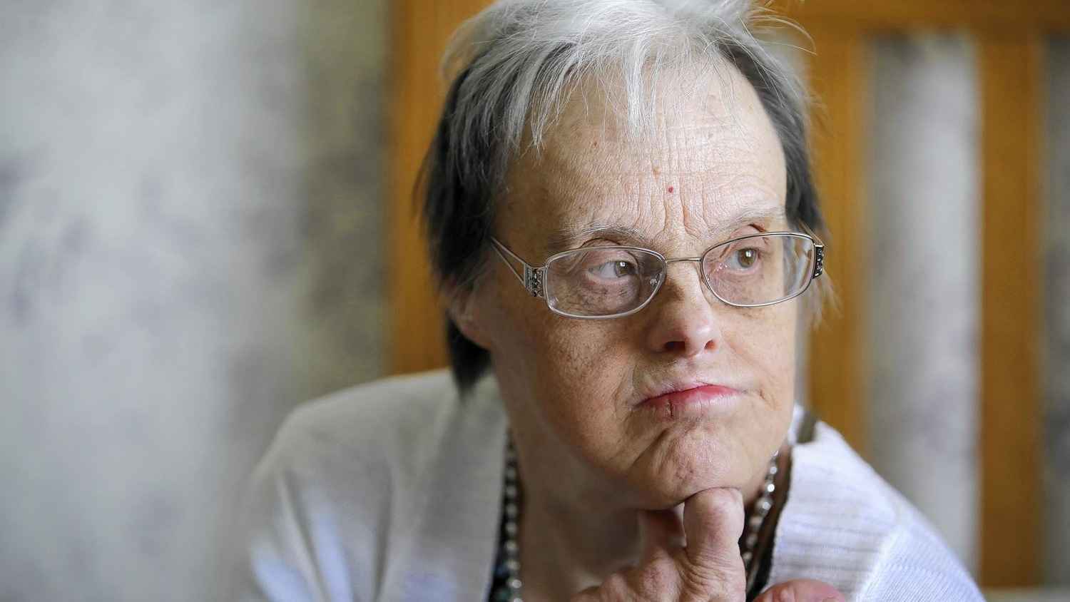 علامات مبكرة للخرف لكبار السن من "متلازمة داون"