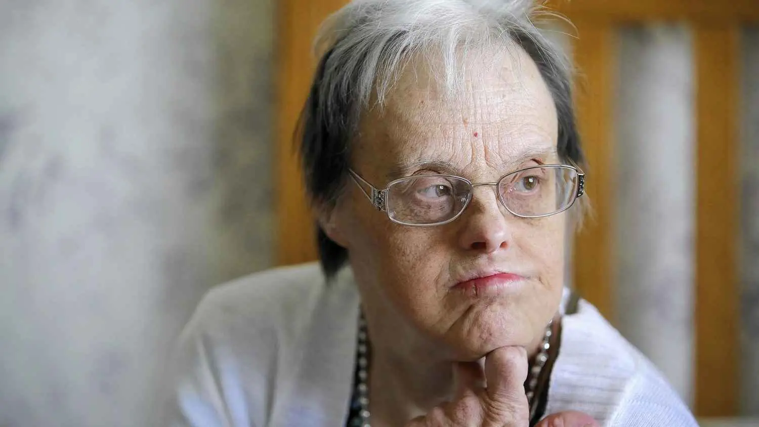 علامات مبكرة للخرف لكبار السن من "متلازمة داون"