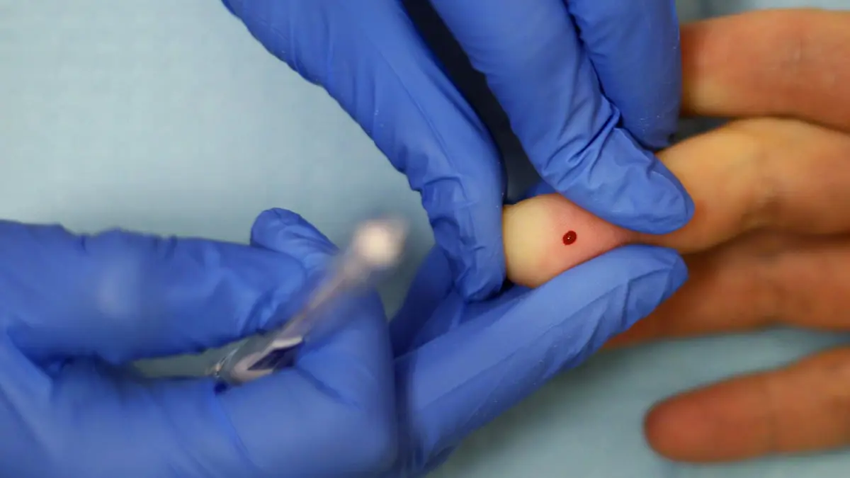 هل يصبح فحص الدم قريبا كافيا لرصد السرطان وتتبع تطوره؟
