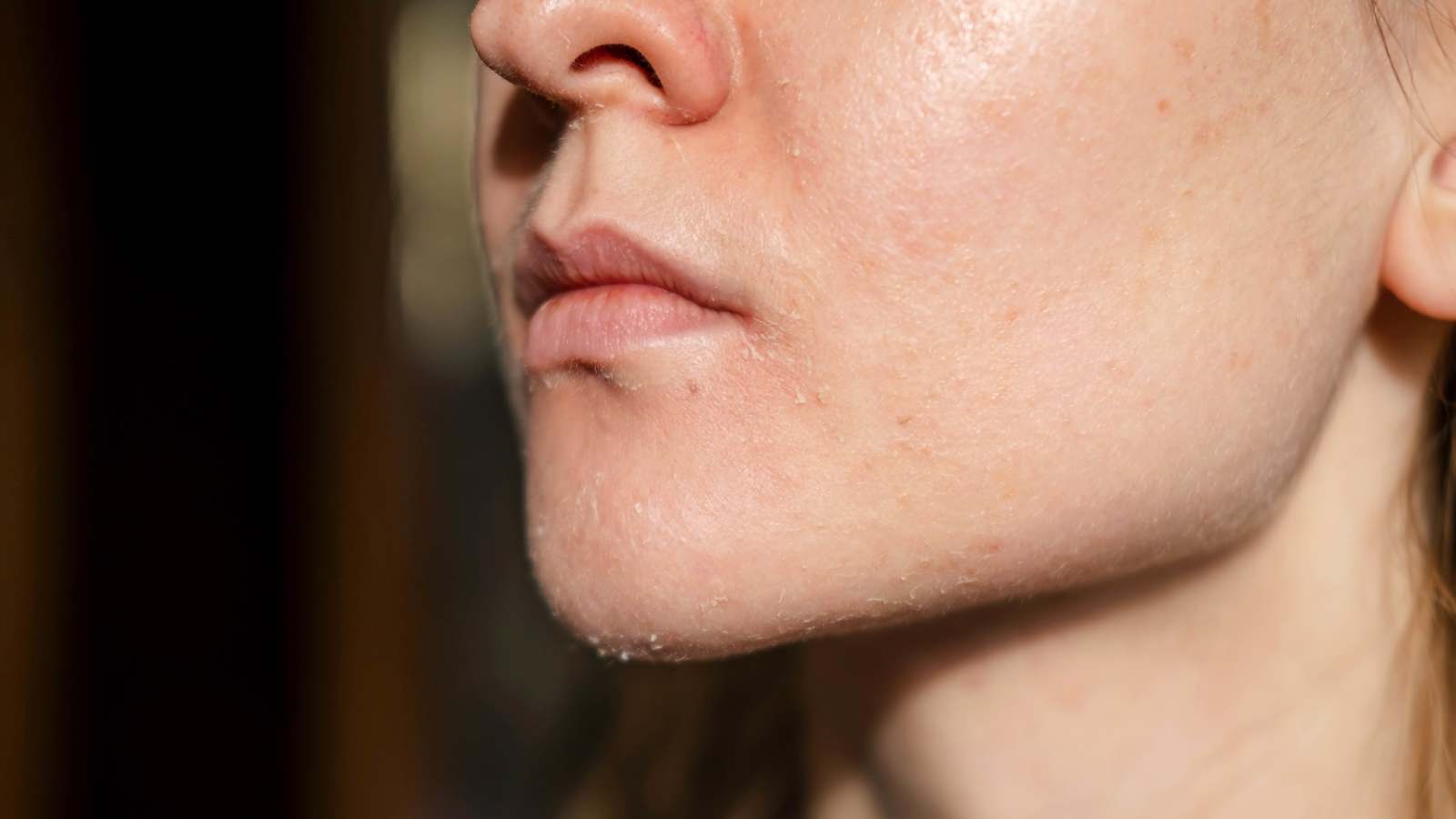 ما تأثير الصيام على صحة الجلد والبشرة؟