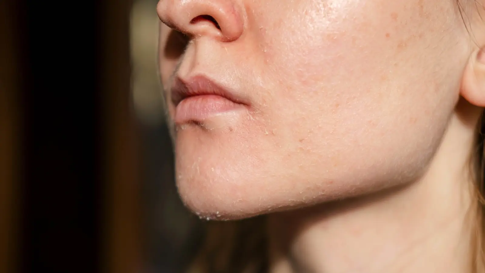 ما تأثير الصيام على صحة الجلد والبشرة؟