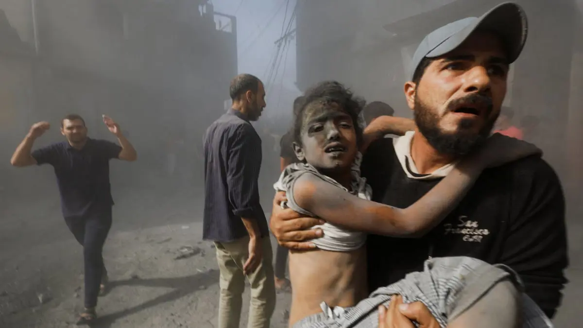  خبراء لـ"إرم نيوز": الحرب تترك آثارًا مدمرة على أطفال غزة
