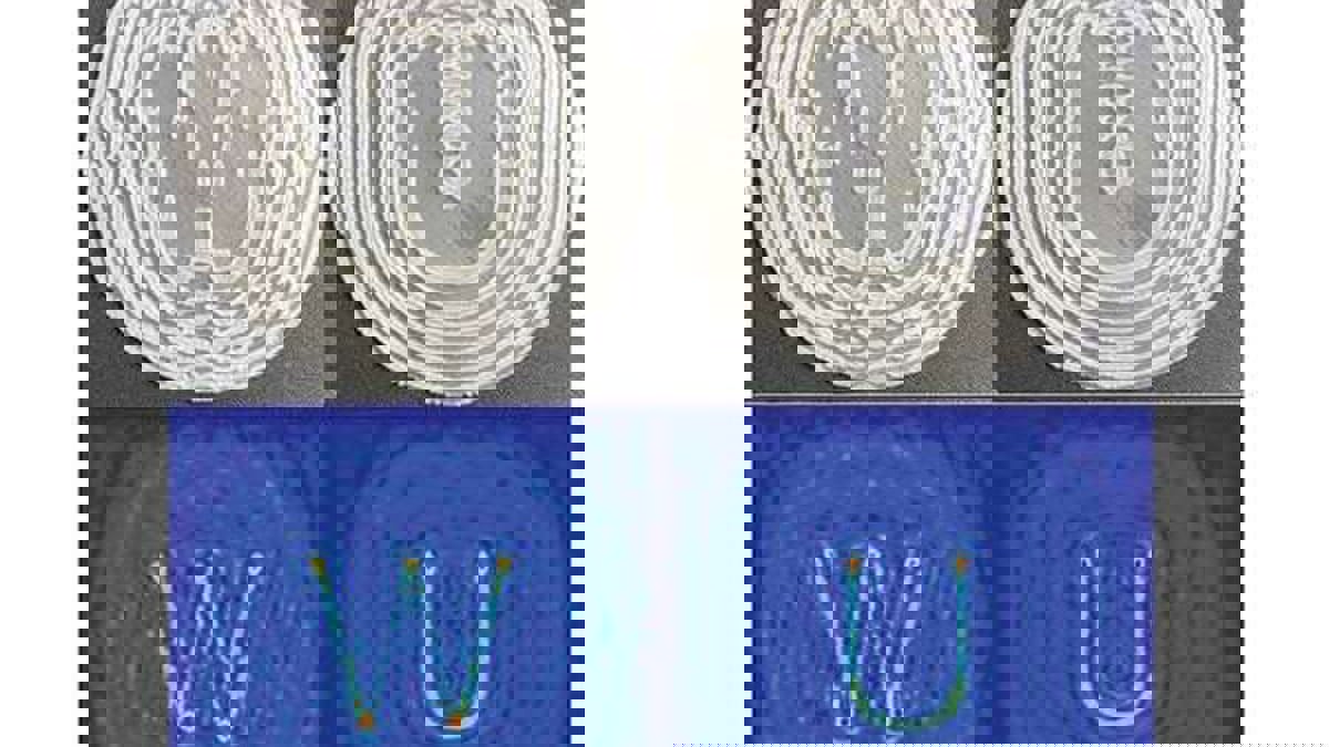 تقنية تحول الموجات فوق الصوتية إلى شكل قوس لتصوير طبي أكثر دقة‬