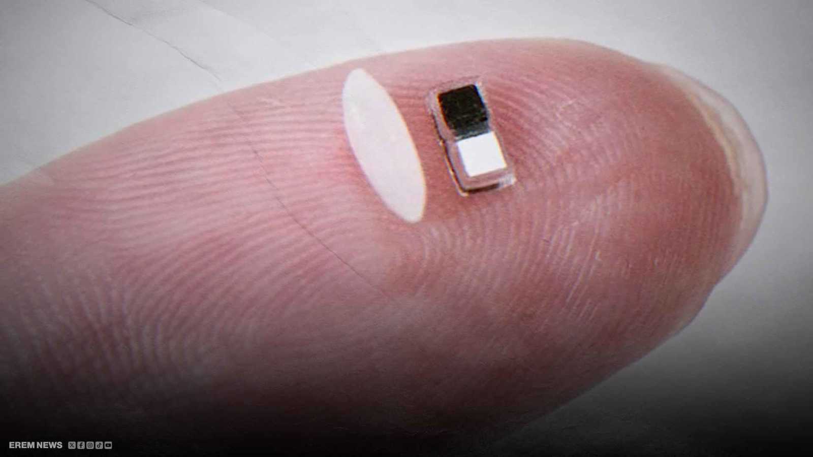 دون جراحة أو أسلاك.. ابتكار منظم قلب بحجم حبة الأرز (فيديو إرم)