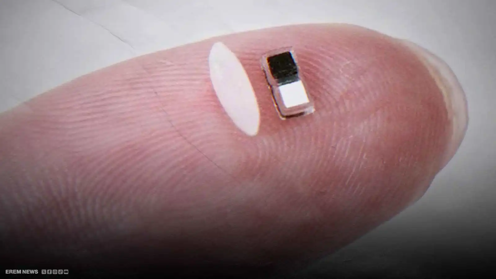 دون جراحة أو أسلاك.. ابتكار منظم قلب بحجم حبة الأرز (فيديو إرم)