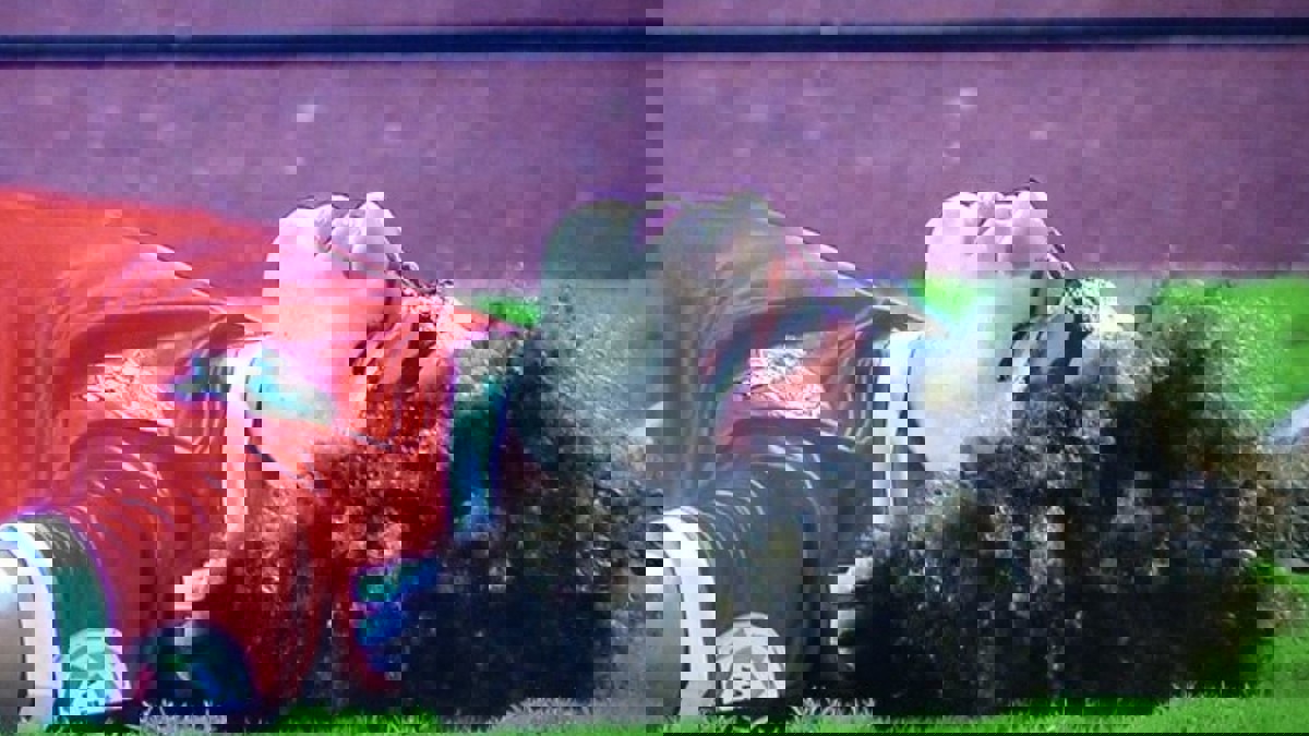 إصابة علي النمر لاعب الوحدة بـ3 كسور في الوجه وكسر بإحدى أسنانه