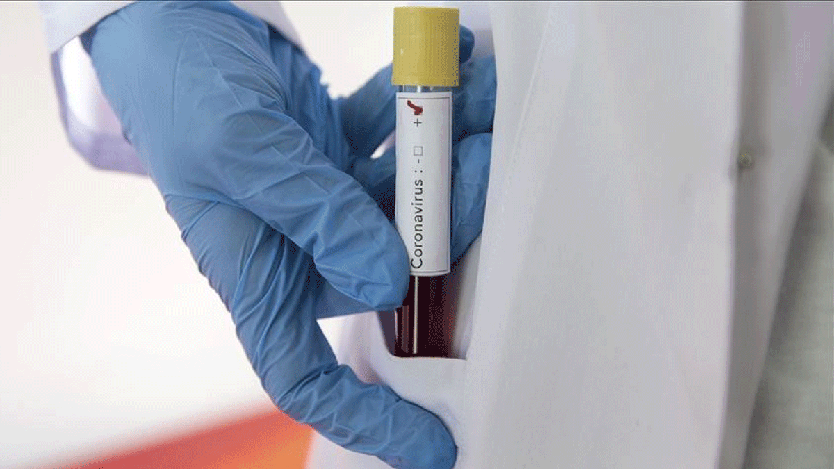 وفاة طبيب إيراني شهير بفيروس كورونا (صورة)