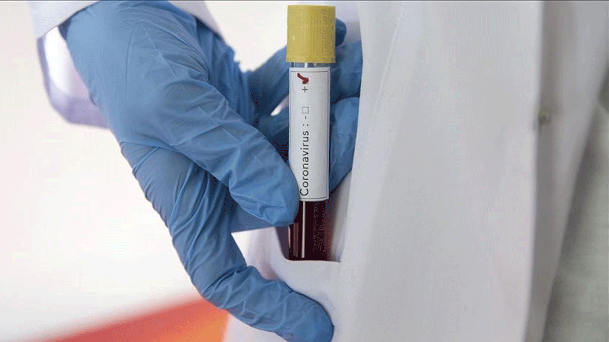 وفاة طبيب إيراني شهير بفيروس كورونا (صورة)