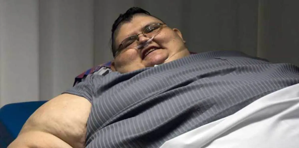 بالفيديو والصور.. أضخم رجل في العالم يقرر التخلص من 300 كغ من وزنه