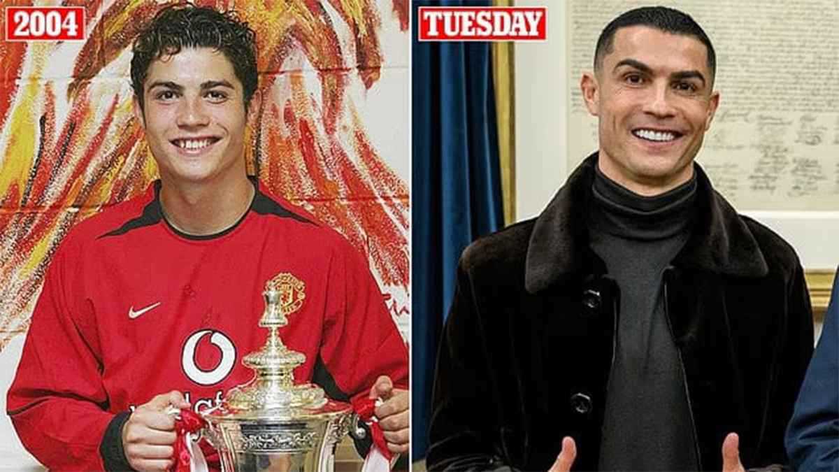 بوتوكس وحقن دهون.. كم عملية تجميل أجراها رونالدو ليحتفظ بوسامته؟ (صور)