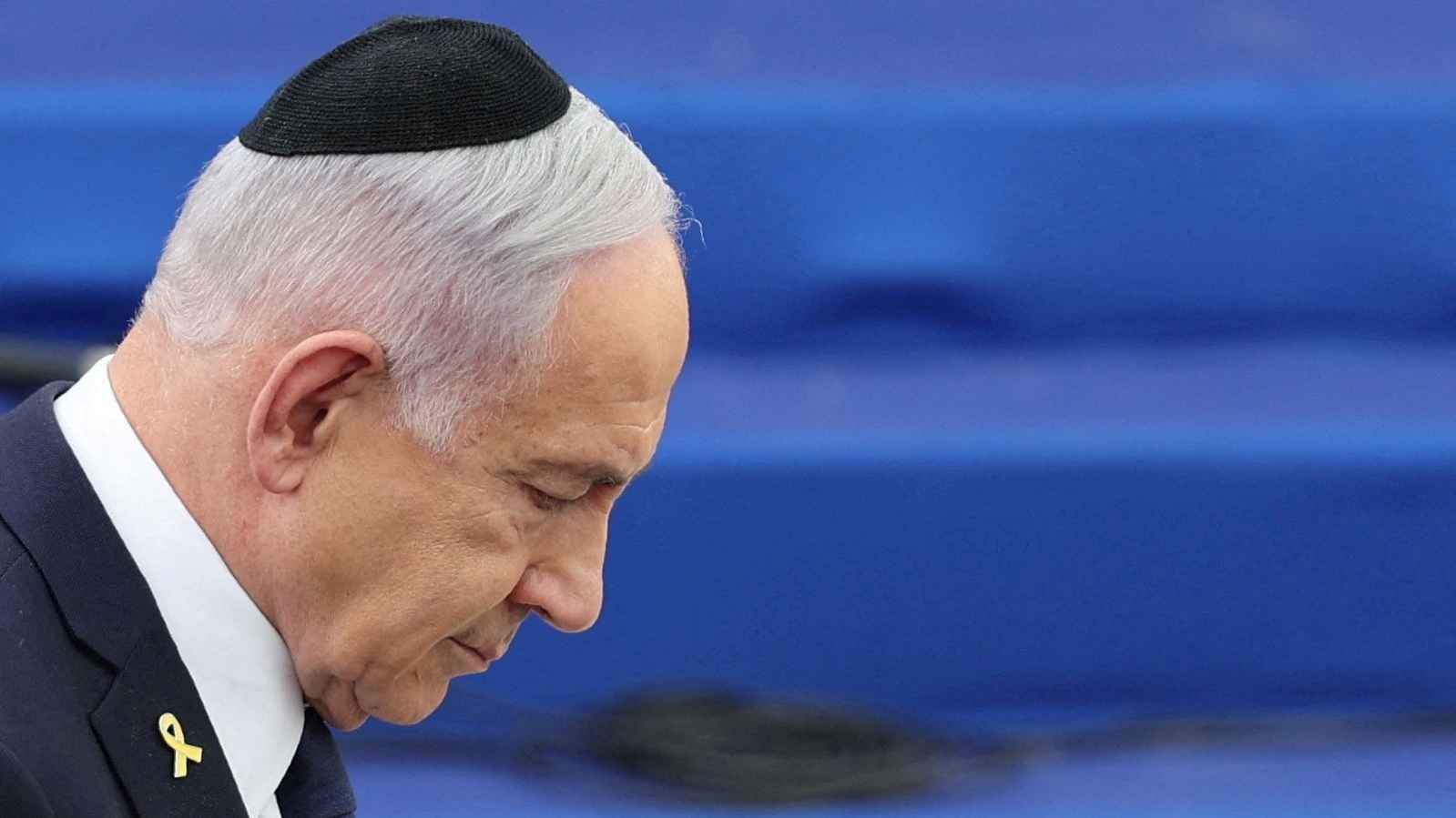 نتنياهو يخضع لعملية "تنظير قولون"