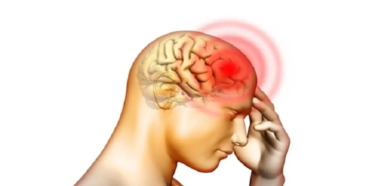 إصابة كل ساعة بالسكتة الدماغية في الإمارات