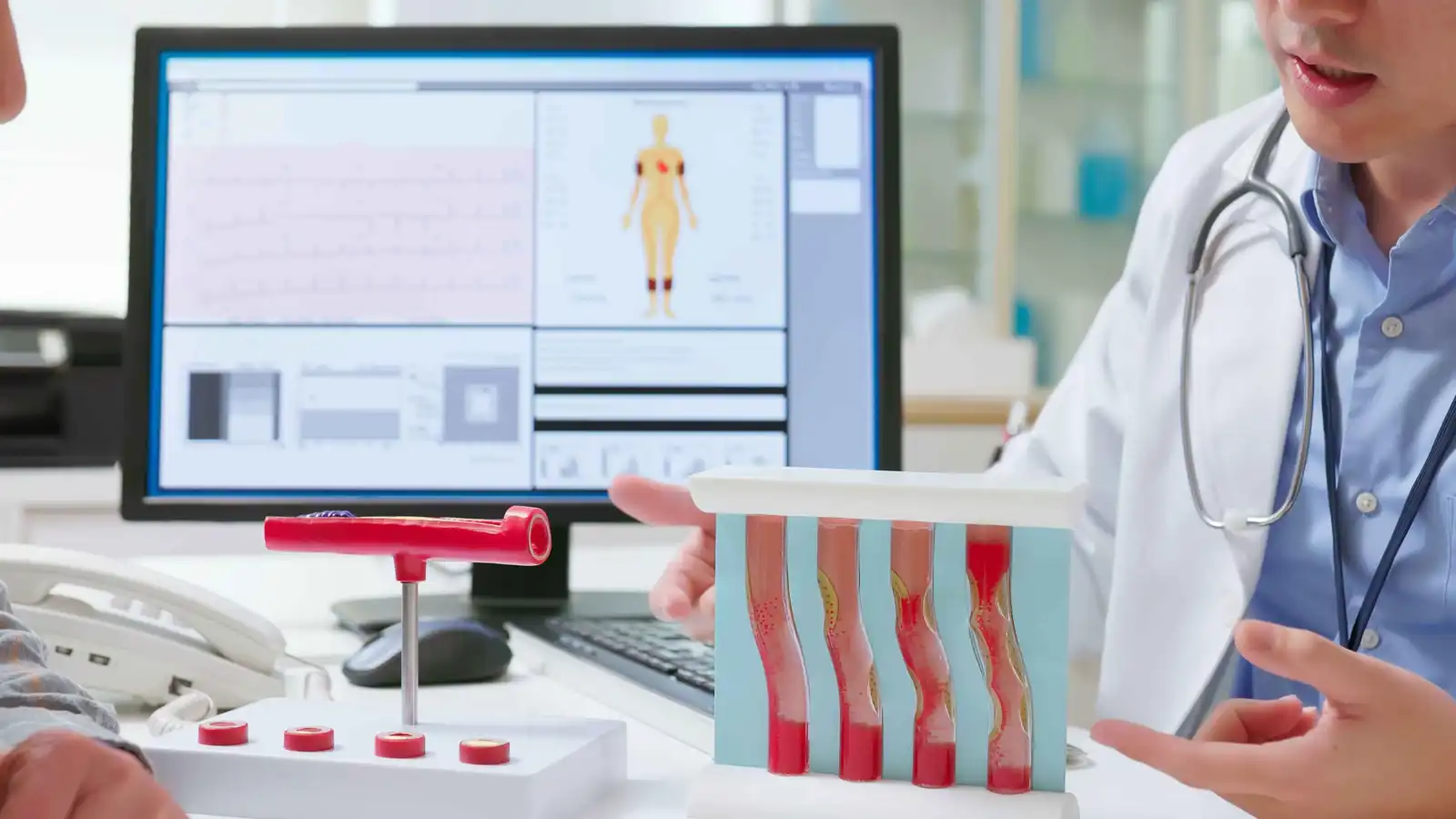 كيف يحمي التشخيص المبكر من تصلب الشرايين؟