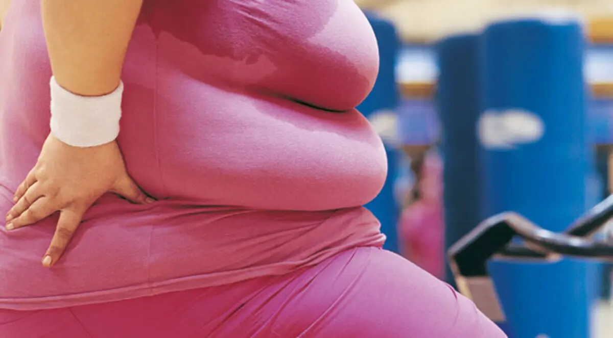 علاج السمنة المفرطة.. مهمة حياة!