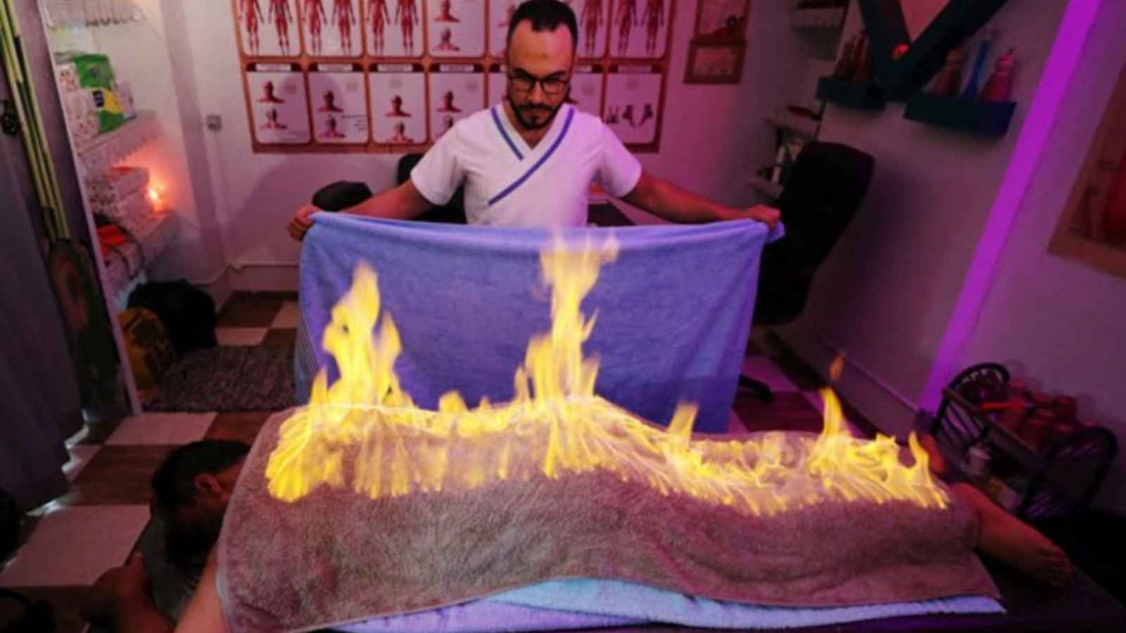 تقنية العلاج بالنار.. هل لها فوائد صحية فعلا؟