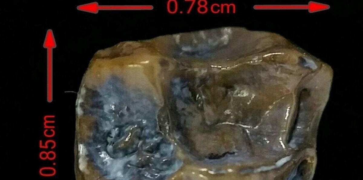 ضرس أحفوري عمره 9 ملايين سنة قد يعيد كتابة تاريخ البشرية