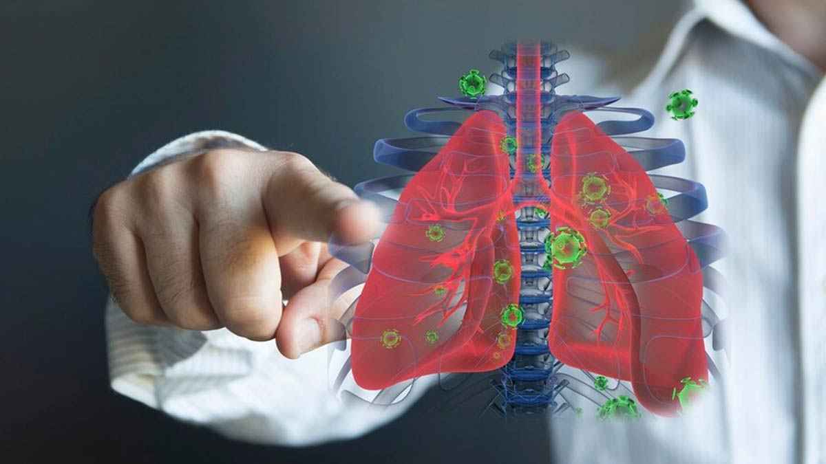 دراسة بحثية: سرطان الرئة يداهم "غير المدخنين" بمستويات مقلقة