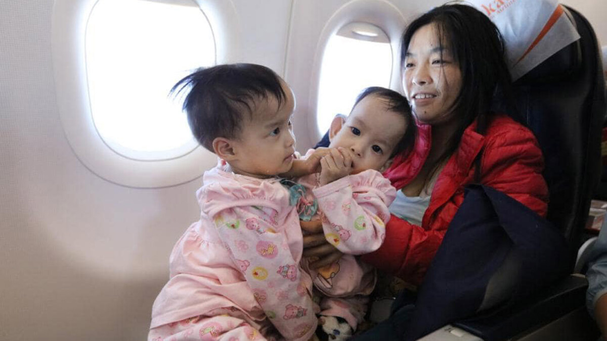 بعد 3 أشهر من عملية فصلهما.. التوأمتان "نيما وداوا" تحرزان تقدمًا هائلًا في التعافي (فيديو)