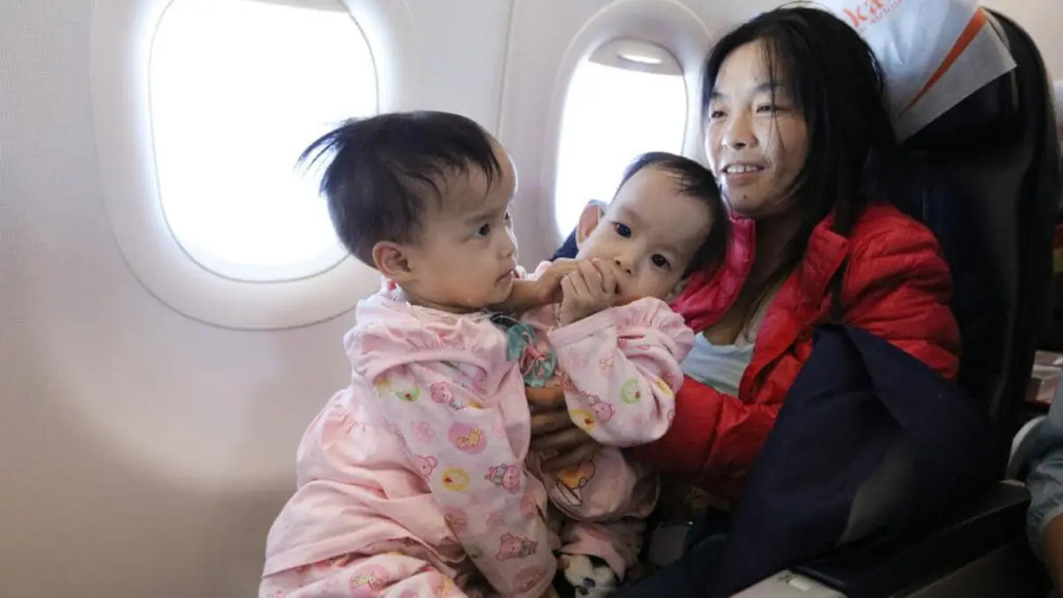 بعد 3 أشهر من عملية فصلهما.. التوأمتان "نيما وداوا" تحرزان تقدمًا هائلًا في التعافي (فيديو)