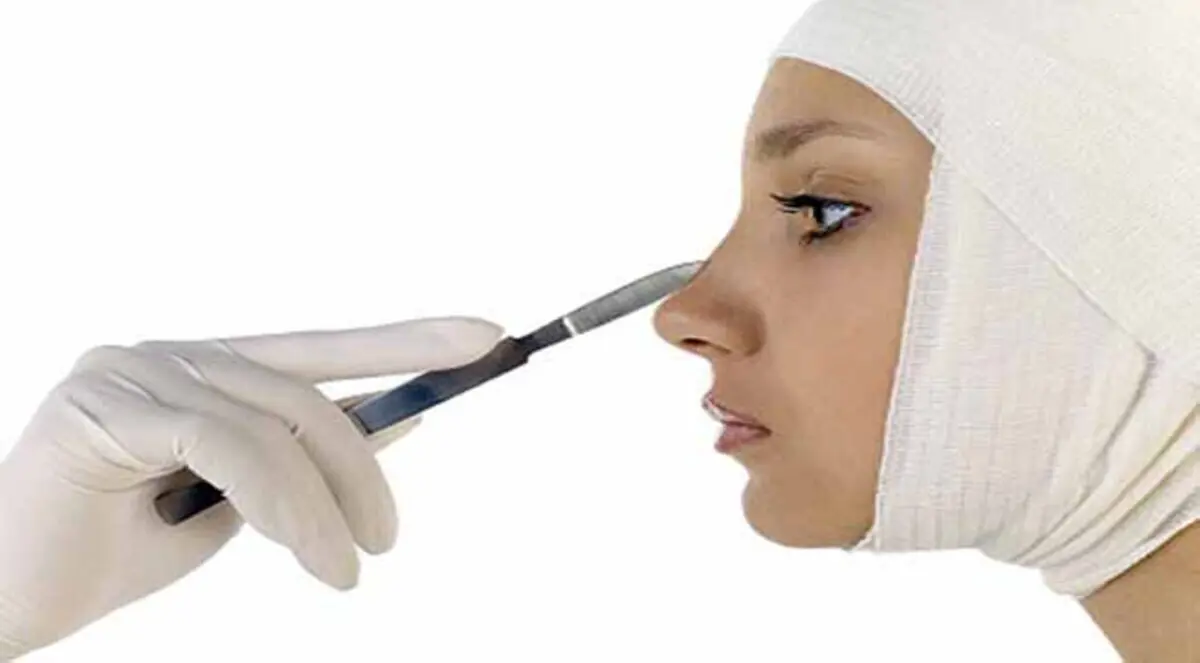 حسناء أسترالية تقارن بين وجهها قبل وبعد جراحة التجميل (صور)