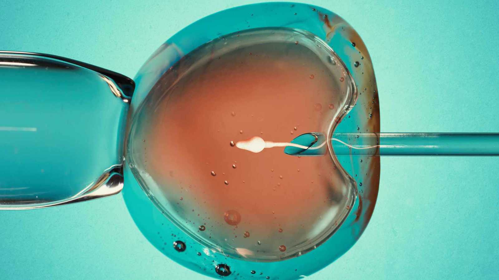 "طفرة جينية" في متبرع بالحيوانات المنوية تهدد حياة 179 طفلا في أوروبا