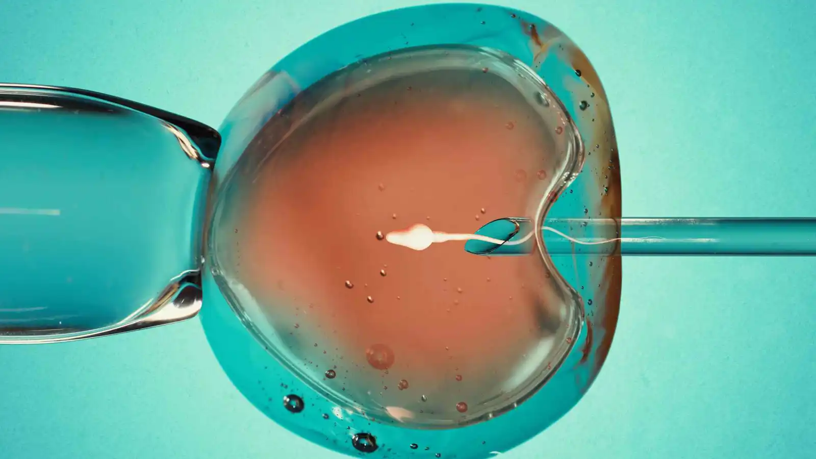 "طفرة جينية" في متبرع بالحيوانات المنوية تهدد حياة 179 طفلا في أوروبا