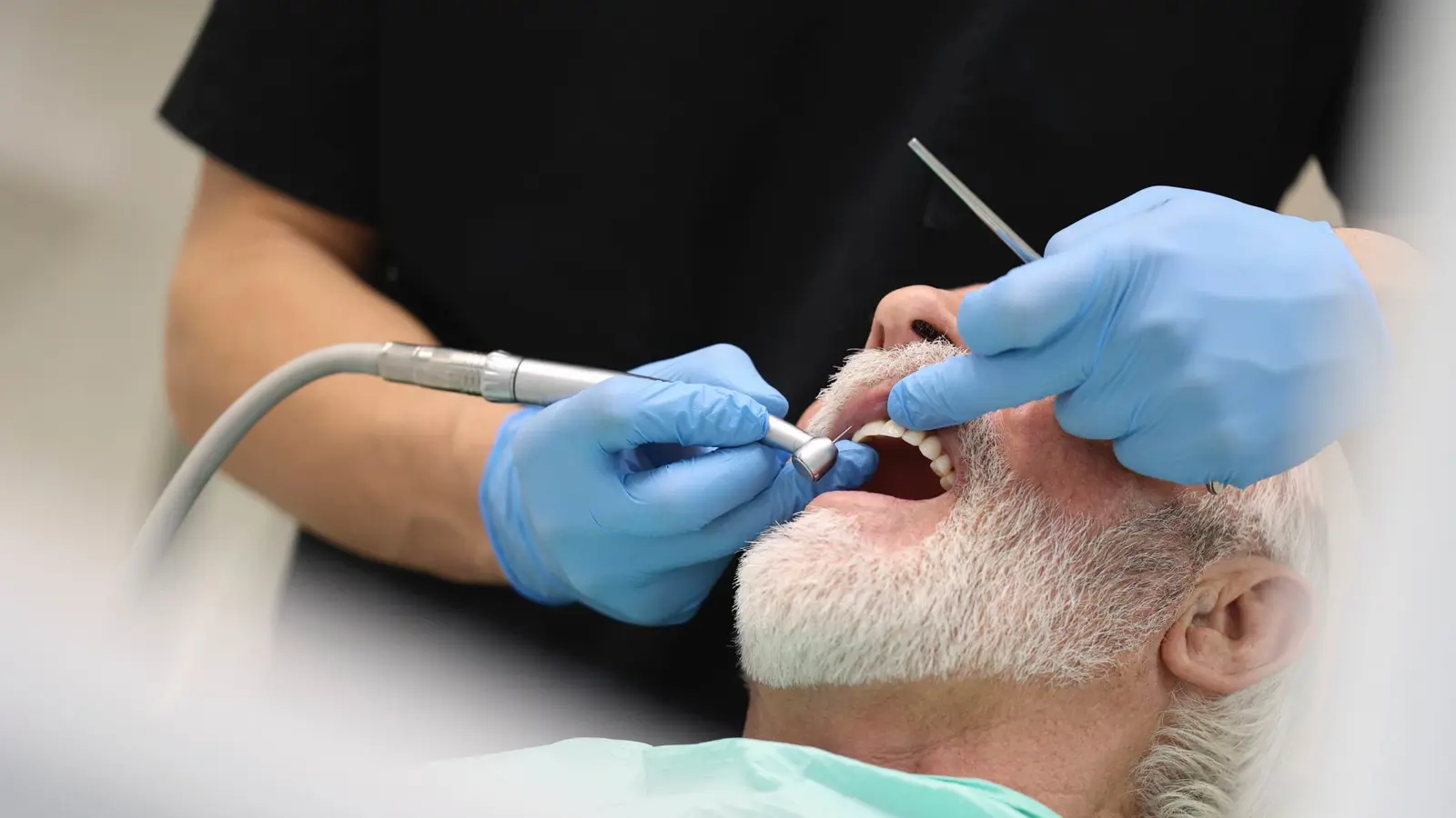 ما سبب تحول أسنان كبار السن إلى اللون البني؟