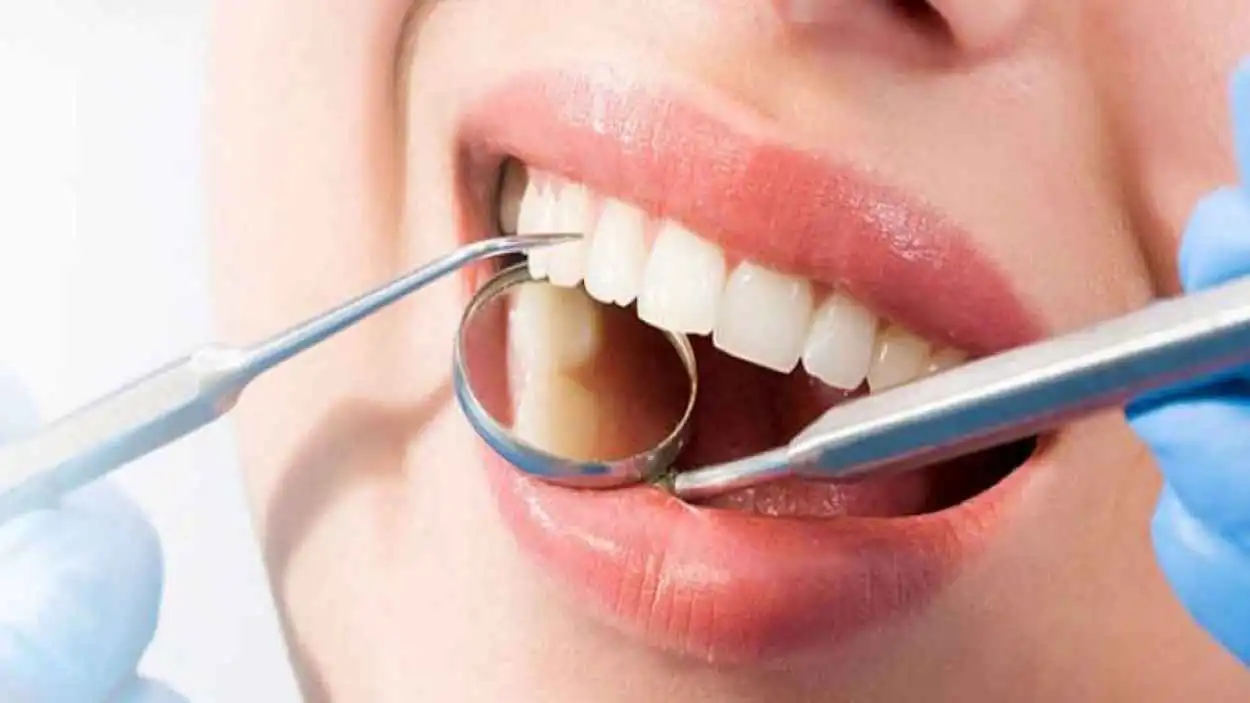 كيف يتسبب السكر بتسوس الأسنان في دقائق؟