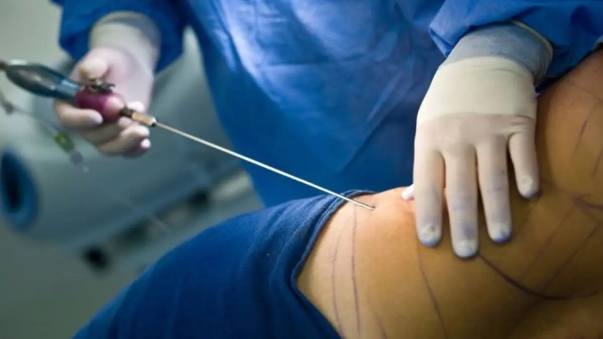 مداهمة مركز تجميل بالأردن تسبب بدخول سيدة للعناية المركزة