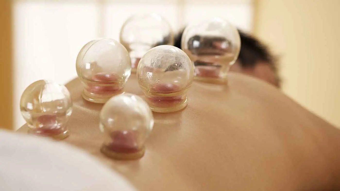 دون تأهيل طبي.. مراكز حجامة "مريبة" تثير مخاوف الجزائريين