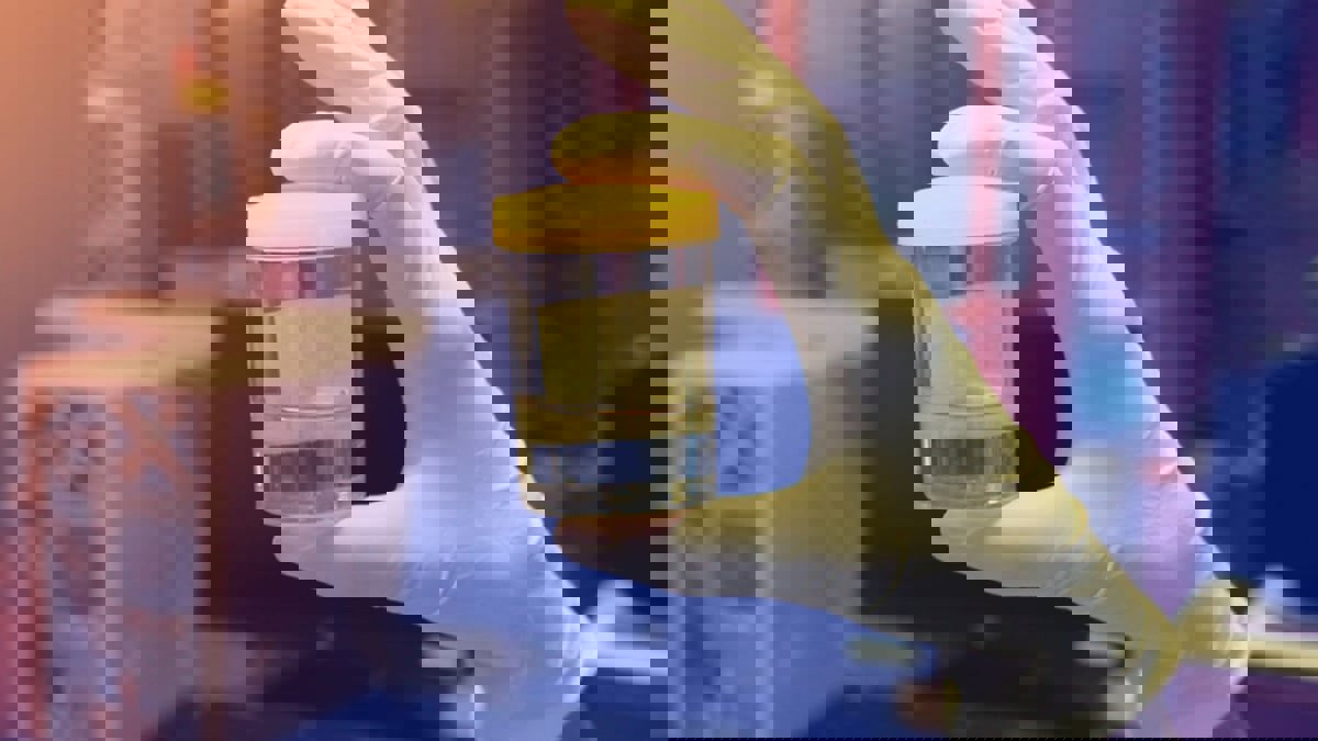 "اختبار بول" قد يسهم في الكشف المبكر عن مرض الزهايمر