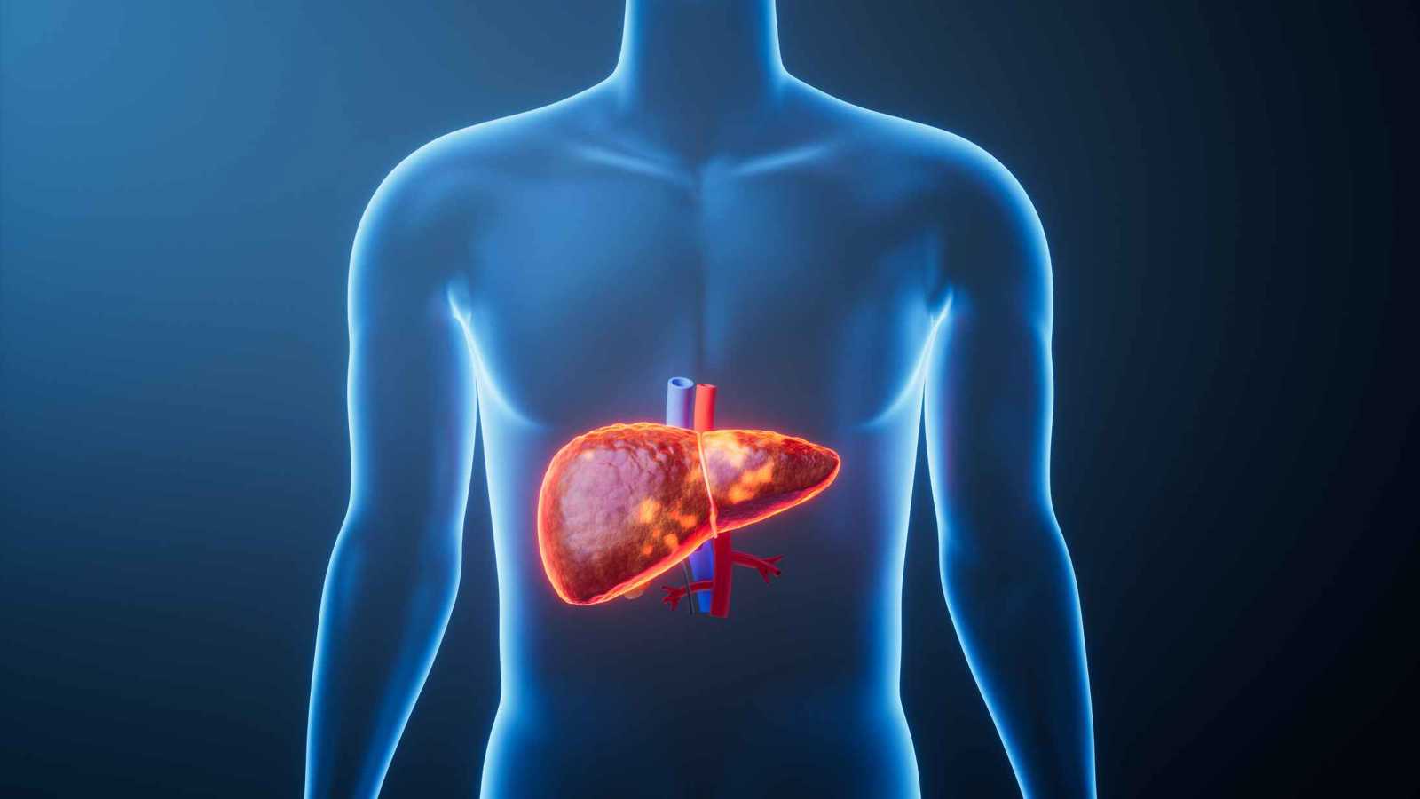 6 أشهر من الحياة.. قصة أول إنسان عاش بكبد خنزير