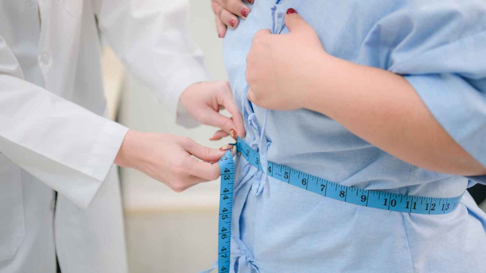 الجراحة تتفوق بخمسة أضعاف على "أوزيمبيك" في إنقاص الوزن