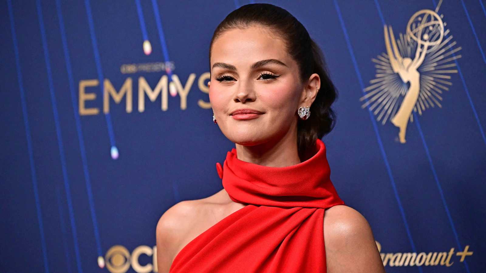 سيلينا غوميز تكشف عن إصابتها بمضاعفات مرض الذئبة