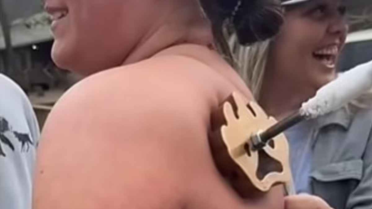 "الوشم بالتجميد".. ظاهرة تجميلية خطيرة قد تسبب السرطان