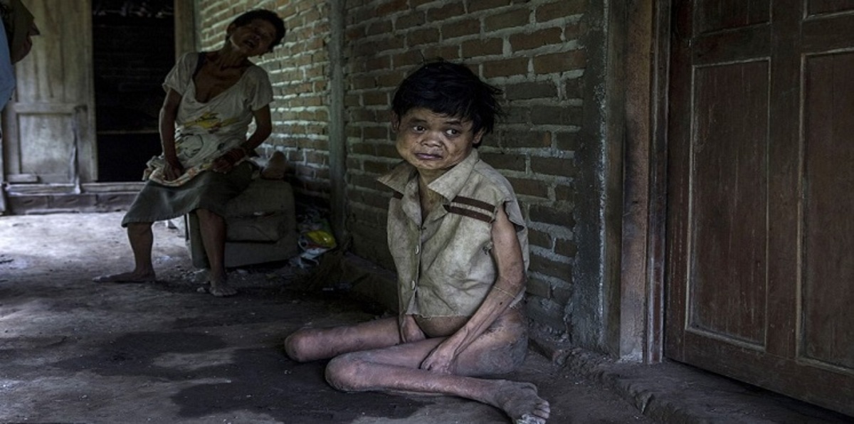 "قرية الملعونين" بإندونيسيا مستعمرة للمختلين عقليًا (صور)