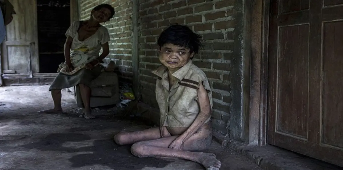 "قرية الملعونين" بإندونيسيا مستعمرة للمختلين عقليًا (صور)