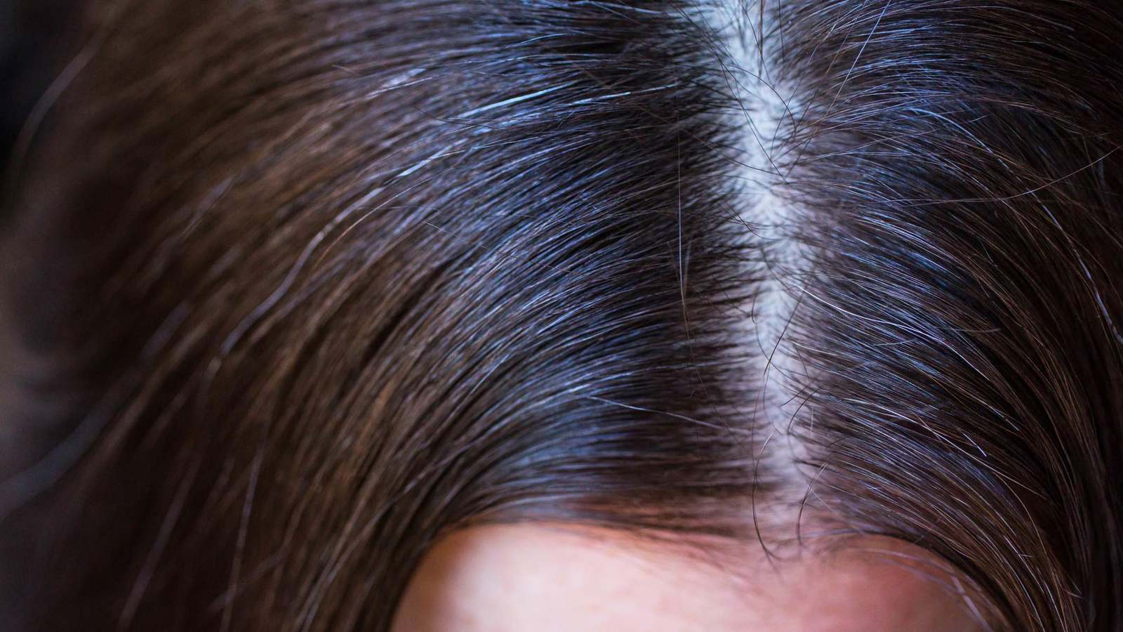 نقص الفيتامينات قد يسبب "الشيب المبكر" للشعر (فيديو)