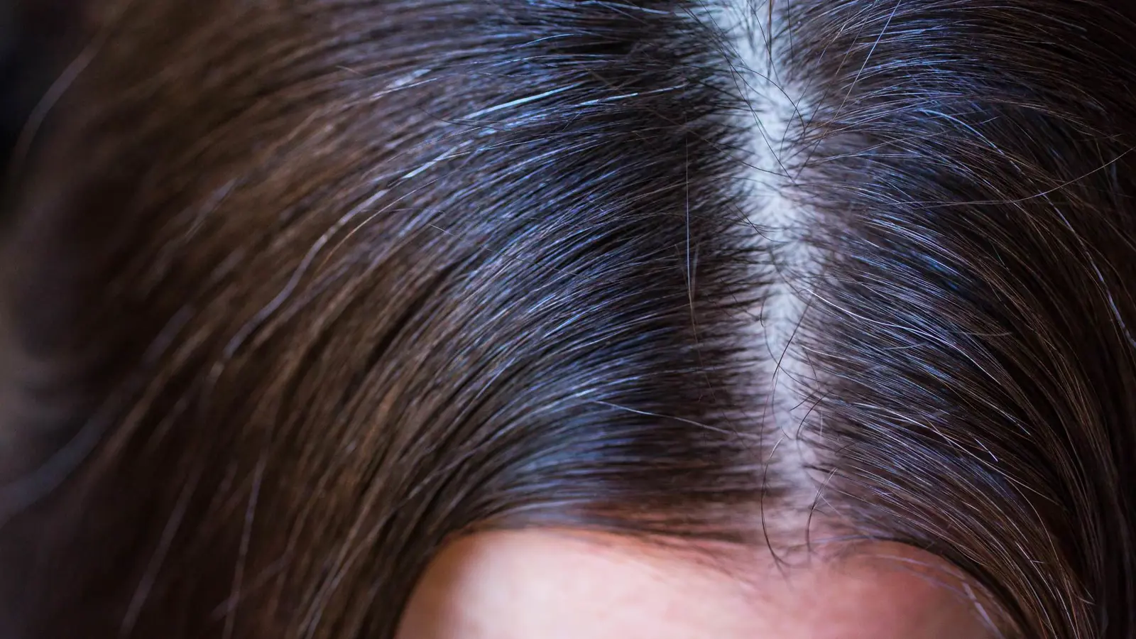 نقص الفيتامينات قد يسبب "الشيب المبكر" للشعر (فيديو)