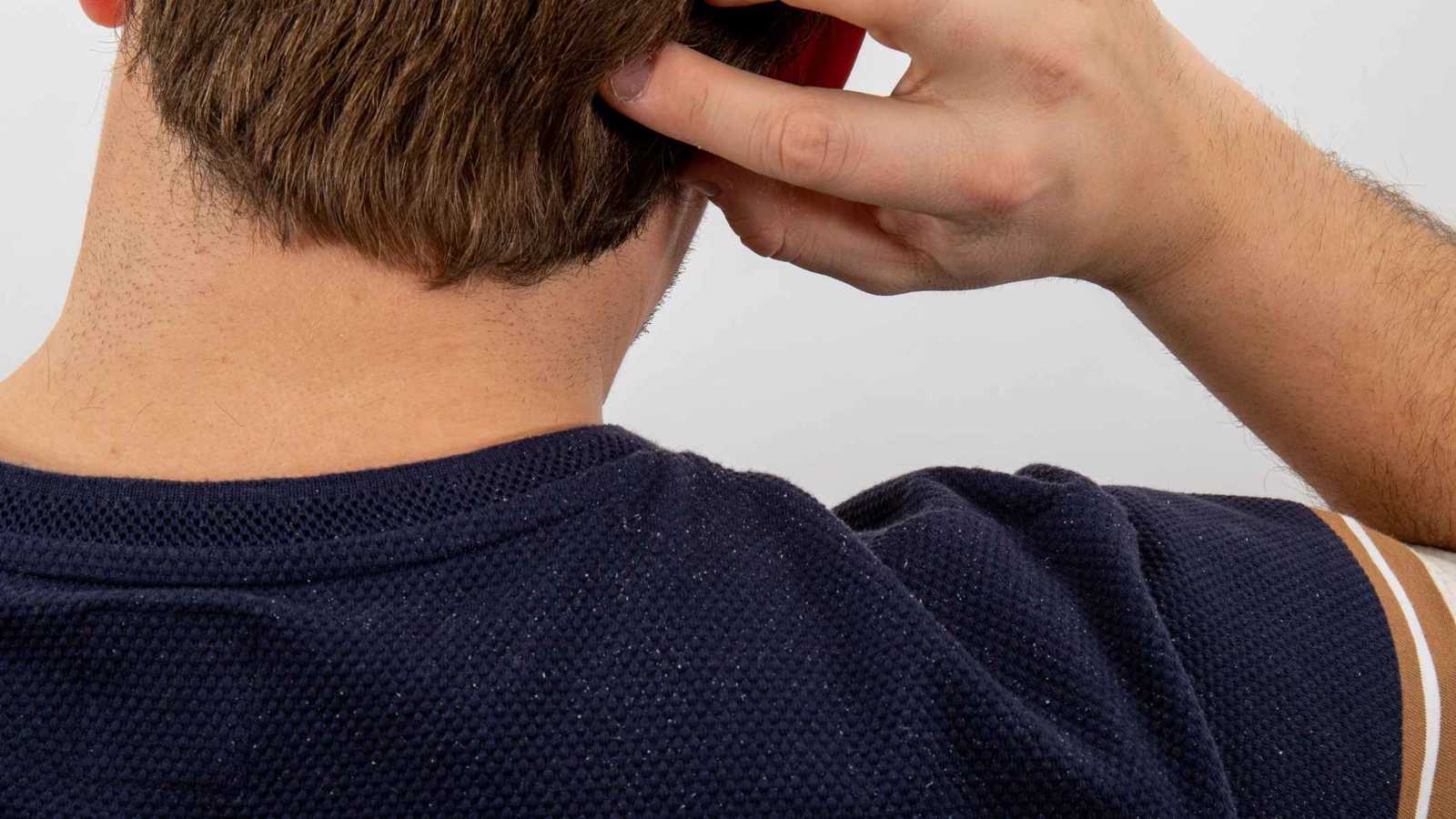 كيفية التخلص من قشرة الرأس بحسب الأطباء