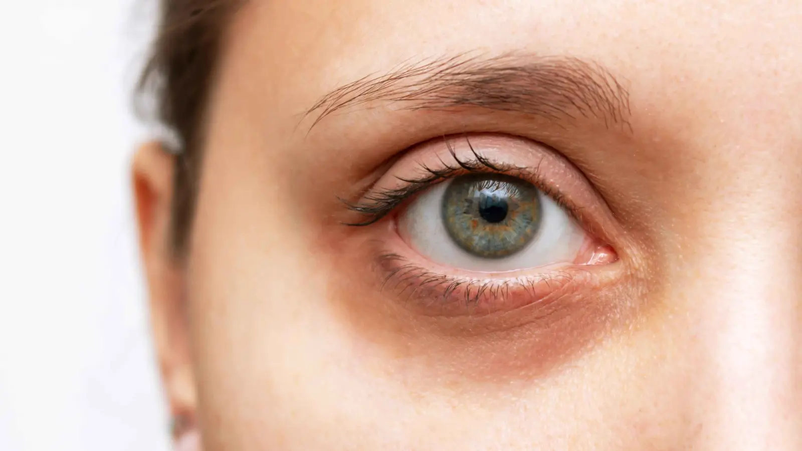 الهالات السوداء والجفاف.. كيف يؤثر عدم شرب الماء على بشرتك؟