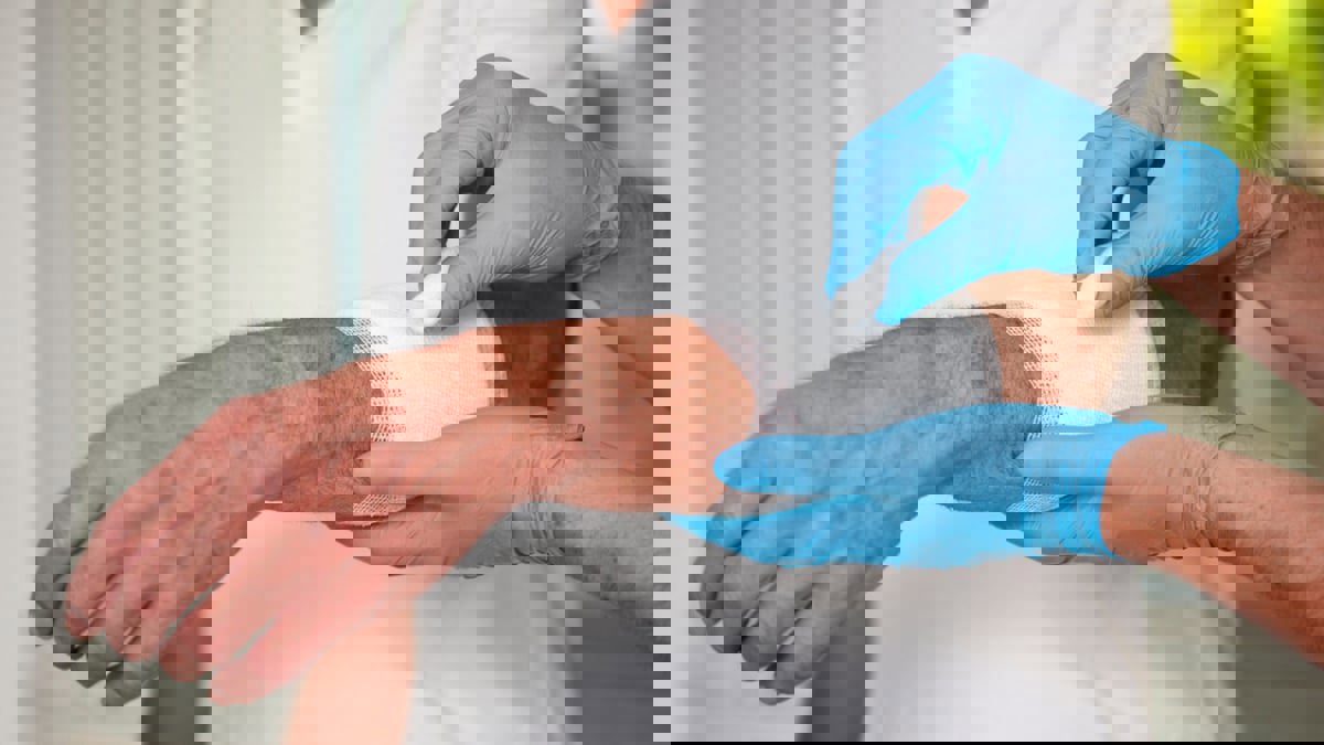 تطوير مرهم من شجرة استوائية يعالج التهابات الجلد المزمنة