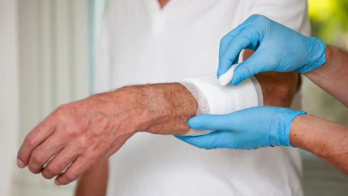 تطوير مرهم من شجرة استوائية يعالج التهابات الجلد المزمنة