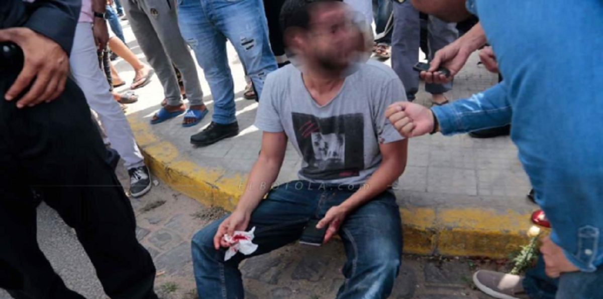 المغرب.. قطع إصبع مشجع للوداد خلال بيع تذاكر مواجهة زاناكو (صور)