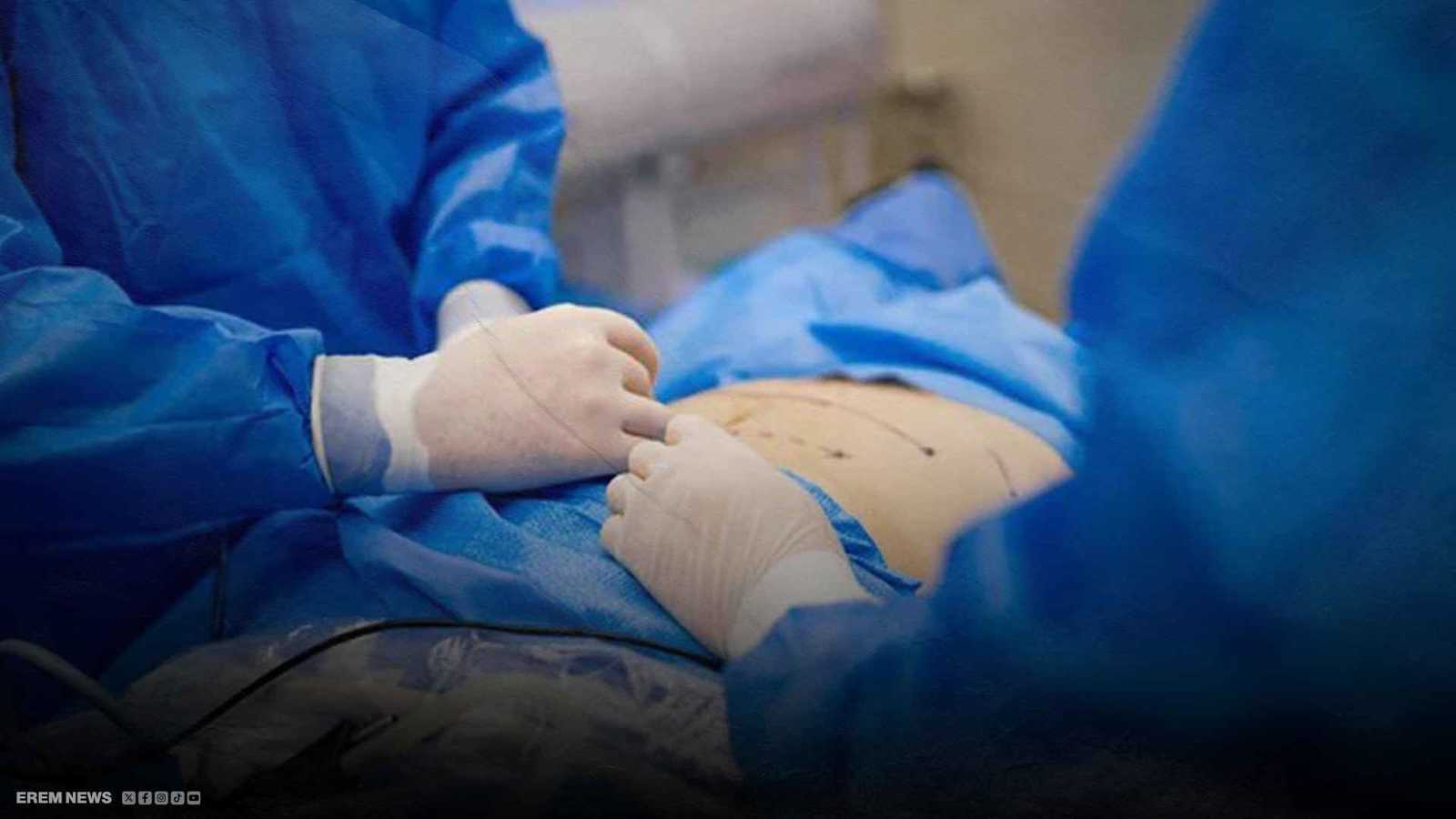 بطن مفتوح وقيح مستمر.. مغنية تركية تعيش كابوسا بسبب "شفط الدهون"