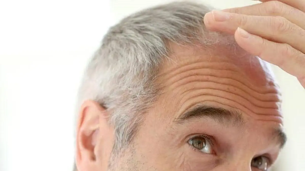 علاجات منزلية تخلصك من الشعر الأبيض