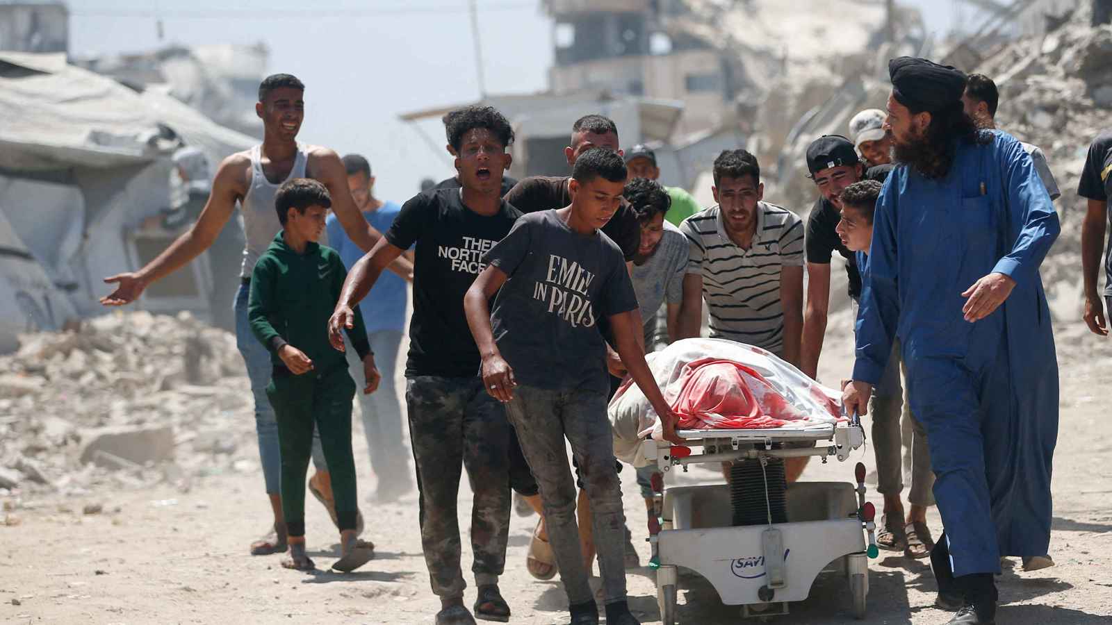 مجاعة غزة تحرم الجرحى من التبرع بالدم