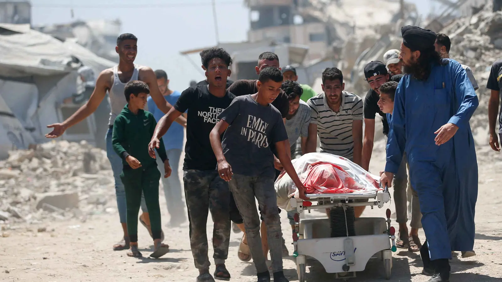 مجاعة غزة تحرم الجرحى من التبرع بالدم